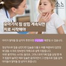 소소아이 네이버블로그