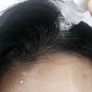 (주)알엔피 | 자란다헤어 라임라이트 알엔피에스 플러스 에이치두피관리 홈케어 MTS 후기