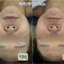 신통한피부관리