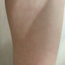 건대 다이어트로 유명한 색갈은짙은갈색: 바이오포톤 다이어트 체험 후기