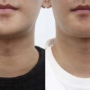 강남역데이원의원 이미지