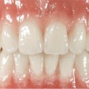 제이치과기공소 이미지