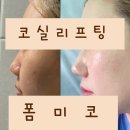 폼미코 홍대피부과 확실한 변화 코실리프팅 후기