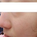 닥터하스킨 이미지