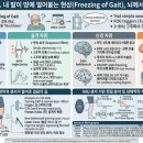 N.H.F.TRADING.CO | Chapter 11. 내 발이 땅에 얼어붙는 현상(Freezing of Gait), 뇌에서는 무슨 일이?