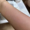 바나다 | 와디즈 바나다 스퀴비 하드왁싱 셋트 내돈내산 후기(털 주의‼️)