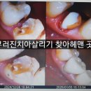 서울보임치과의원 네이버블로그