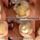 예샘치과기공소 이미지