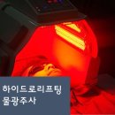 오라클 피부관리 이미지