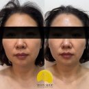 문샵 | 수원 피부관리 후기로 증명하는 만족도 높은 곳, 문샵 스킨앤바디