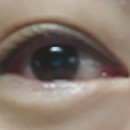 난초꽃피다임앤오안과의원 이미지