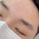 인브로우 이미지