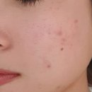 예쁜여우피부관리 이미지