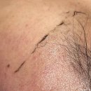 GS25통진서암점 | 잠실 피부관리 에어리스킨룸 세라링 전후비교 만족 후기