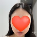 팜트리 스티모시카 앰플 젤 에너지크림 성인여드름 화장품 내돈내산 후기