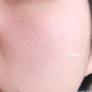 삼산맑은약국 | 멜라논크림 사용법 부작용 기록중