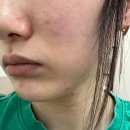 서우목장 | 광주 피부관리샵 일곡동 서우뷰티 얼굴관리후기