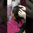 쵸이스셀테라피