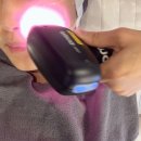 이수역 | 이수역 피부과 티타늄리프팅 후기 60kj 효과 2주차