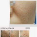 여드름에좋은천연팩 | 손쉽게 만드는 여드름에좋은천연팩 이미지