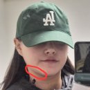 두리밴딩 | 이중턱 지방흡입 + 근육묶기 내돈내산 리얼후기 *2탄* (일주일차 통증, 흉터, 부작용 총정리) feat.입술...