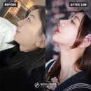 제이티성형외과의원 이미지