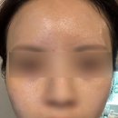 더엠뷰티셀럽 | 연산동 피부관리 H뷰티엠 여름철 홍조 열감 내리는 진정케어 후기