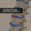 만성원광한의원 네이버블로그