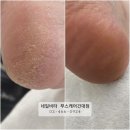 네일비타&푸스케어(건대점) | 건대 발각질 네일비타&amp;푸스케어 건대점 후기