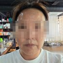 봉선동피부관리 한 번 받고 인상이 달라졌어요! 위드비비드뷰티샵 솔직 후기