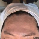 세라헤어라인 이미지