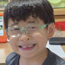 속초엔 엘에이치과의원 | 속초에도 야간진료 가능한 소아 치과가 있다! 복덩이 유치 발치 기록