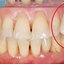 유니치과기공소 이미지