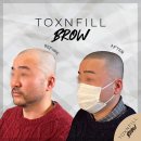 톡스앤필브로우