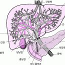 간 질환증상, 복수 이미지