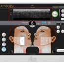 라임 | 홍대피부과의원, 울쎄라피프라임 후기 정말 믿을만할까? <진실공유>