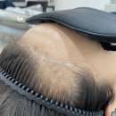 헤어라인 - 고양시 일산동구 | 헤어라인