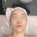 본에스테틱올가휴천안 | 송도 에스테틱 모공디톡스 강추 후기 올가드림뷰티 데콜테까지 해주는 곳