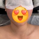 지에너지 | [잠실 윤곽 관리] 잠실 '오늘뷰티' 에너지 테라피 풀페이스 리프팅 케어 후기