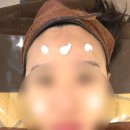 서면여드름•문제성 피부전문관리 “미소뷰티” 인모드리프팅 탄력관리 받은 후기