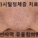 투앤티의원 | 가시털정체증 원인, 관리, 레이저 후기