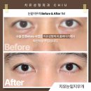 치유성형외과의원 이미지