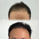 노스탈