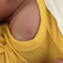 에버메디(주) | 신생아 BCG피내용 예방접종 후기｜피내용·경피용 차이부터 접종 후 주의사항까지(구리장스365)