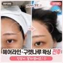 타임왁싱샵 왁싱 후기｜잔털까지 깔끔하게 정리된 헤어라인