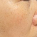 (주)아이바이오메디칼 | 바이오힐 보 프로바이오덤 3D 리프팅 L-PDRN 크림 찐 사용후기 💜