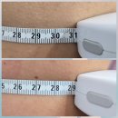 청라에너지 | 청라 리바디라인에서 팔뚝살 빼빼팔 에너지테라피 고주파관리 후기