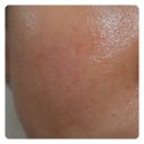 (주)네오티스 | 피부 재생크림 [네오티스 pp cream 포스트 프로시쥬어 크림]