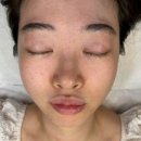 디바스킨클리닉 | 나주피부관리 나주혁신도시 블랙헤드제거 디바스킨클리닉 후기