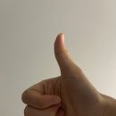 고이비인후과의원 네이버블로그